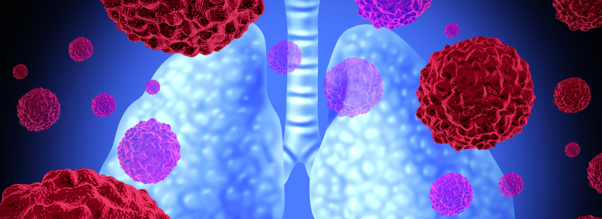 Imagen de pulmones